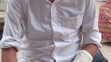 कुत्ते के हमले में युवक गभीर रूप से हुआ घायल