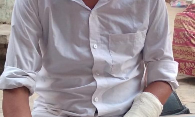 कुत्ते के हमले में युवक गभीर रूप से हुआ घायल कुत्ते के हमले में युवक गभीर रूप से हुआ घायल