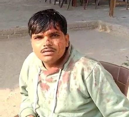 जानलेवा हमला कर बिल्डिंग मैटेरियल व्यापारी को किया लहूलुहान, चलाई गोली