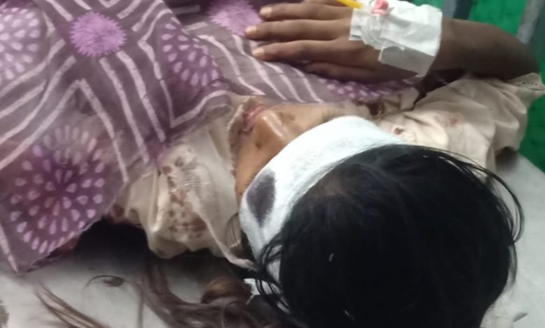 भिलाई: नेशनल हाईवे फिर हुआ खून से लाल, पिता बेटी ने तोड़ा दम भिलाई: नेशनल हाईवे फिर हुआ खून से लाल, पिता बेटी ने तोड़ा दम