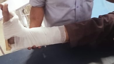 भिलाई: बीएसपी प्लांट में हादसा ,ठेका श्रमिक का पैर टूटा