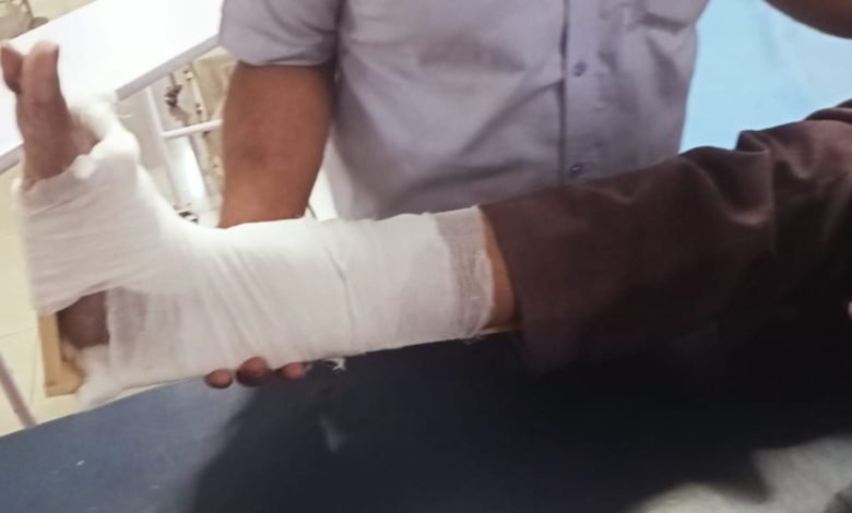 भिलाई: बीएसपी प्लांट में हादसा ,ठेका श्रमिक का पैर टूटा